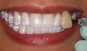 Case 12 after