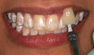 Case 12 before
